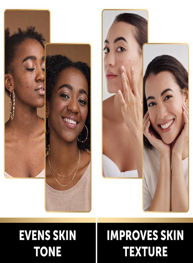 VALITIC Brightening Lemon & Turmeric Kojic Acid Soap with Vitamin C, Retinol, Collagen - Original Japanese Complex Infused with Hyaluronic Acid, Vitamin E, Shea Butter - Dark Spot Corrector (3 Pack) - Image 2