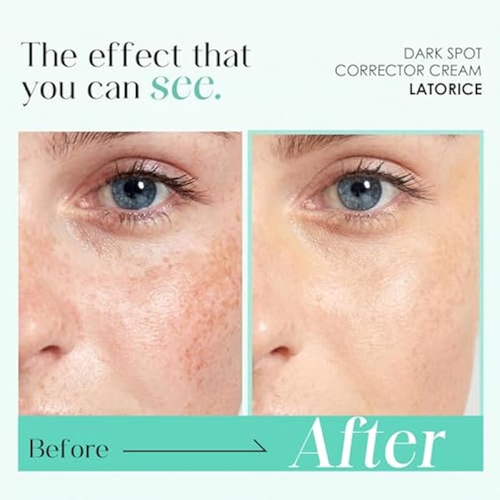 LATORICE Dark Spot Remover for Face and Body: Tranexamic Acid Serum for Women and Men - Reduce Sun Spot Melasma Freckles - Natural Ingredient Enriching Skin Care (1.7 Fl Oz) - Image 4