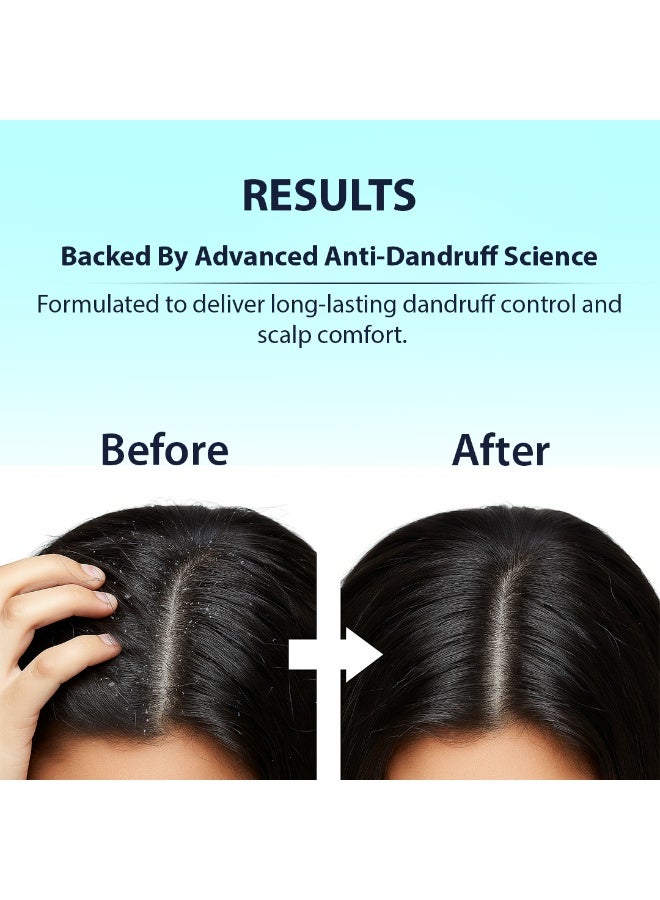 Dermistry Anti-Dandruff Hair Mask 200ml for All Hair Types - Image 5