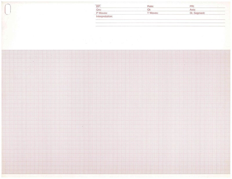 ECG/EKG Paper for Burdick 007966,007868-216mm X 280mm X 200 Sheets (1)