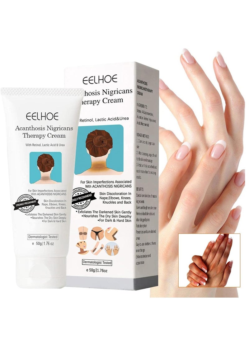 EELHOE Lightening Cream For Dark Spots | Acanthosis Nigricans Dark Skin Nourishing Cream - 1.76oz Soft Brightening Cream White Cream, Hydrating Cream for Joint Elbow Ffxs - Image 1