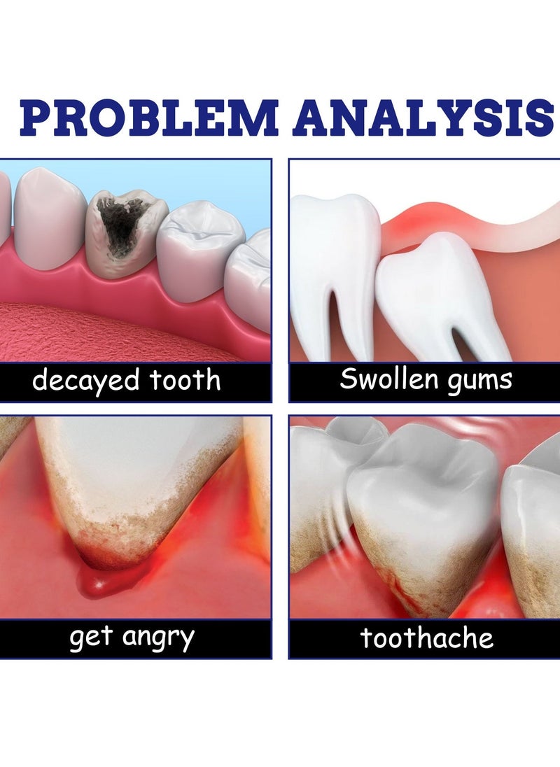 SOUTH MOON 3-PACK Of Tooth And Gum Sprays, Toothache Relief Spray 20ml*3 - Image 3