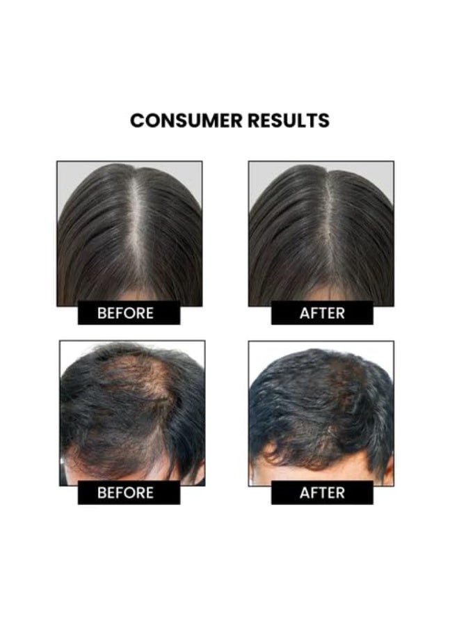 ثريفيكو شامبو ثرايف كو روزماري للتحكم في تساقط الشعر ونمو الشعر المتقدم | يعزز جذور الشعر القوية وفروة الرأس الصحية | مع إكليل الجبل وماء الأرز وببتيد البازلاء والكافيين وHyaplex™ | جميع أنواع الشعر | للرجال والنساء | 100 مل - Image 4