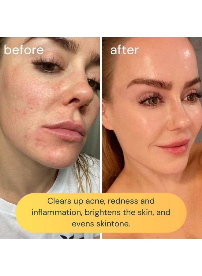 KOA LIFE KOA LIFE Vit-C Brightening Facial Cleanser - Vitamin C Facial Cleanser Wash, Skin Brightening Face Wash, Gentle Foam Cleanser, Vegan - 1.7 Fl Oz  - Image 3