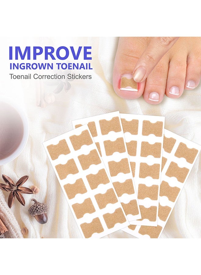 Sefudun Toenail Correction Stickers, Ingrown Toenail Corrector Patch,  Ingrown Toenail Corrector Strips, Toenail Correction Patches, Ingrown Toenail Treatment Tool Foot Care, No-Glue Toenail Correction Stickers 100PCS - Image 2