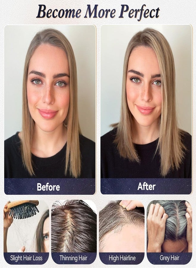 starluck Real Human Hair Toppers for Women 10Inch-Suitable for Thinning Hair no Bangs 3 * 4.5inches Swiss Base Hand-Tied & 3 Secure Clips(4T10/16#) - Image 4