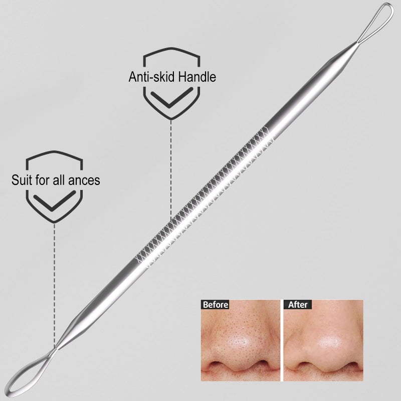 Cbiumpro 6 Pack Blackhead Remover Tools, Pimple Popper Tool Kit, Professional Blackhead Extractor for Zit, Acne, Whitehead, Comedone on Nose - with Case - Image 3