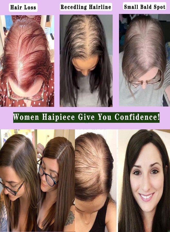Voloria 12INCH Hair Toppers for Women Real Human Hair Topper Miduim Density Full PU Base Hairpiece Hair Extensions (#4 Medium Brown Color) - Image 5