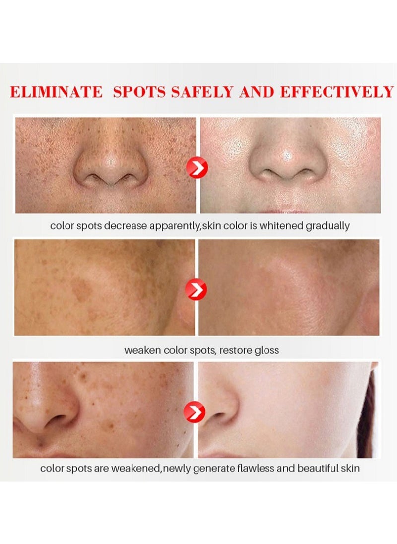iBealee - Skin Whitening Freckle Cream, Anti-Spot Face Cream, White Lightening Beauty Blemish Face Treatment, Lightweight & Non-Greasy Face Moisturizer, for Day & Night Use, 20g - Image 1
