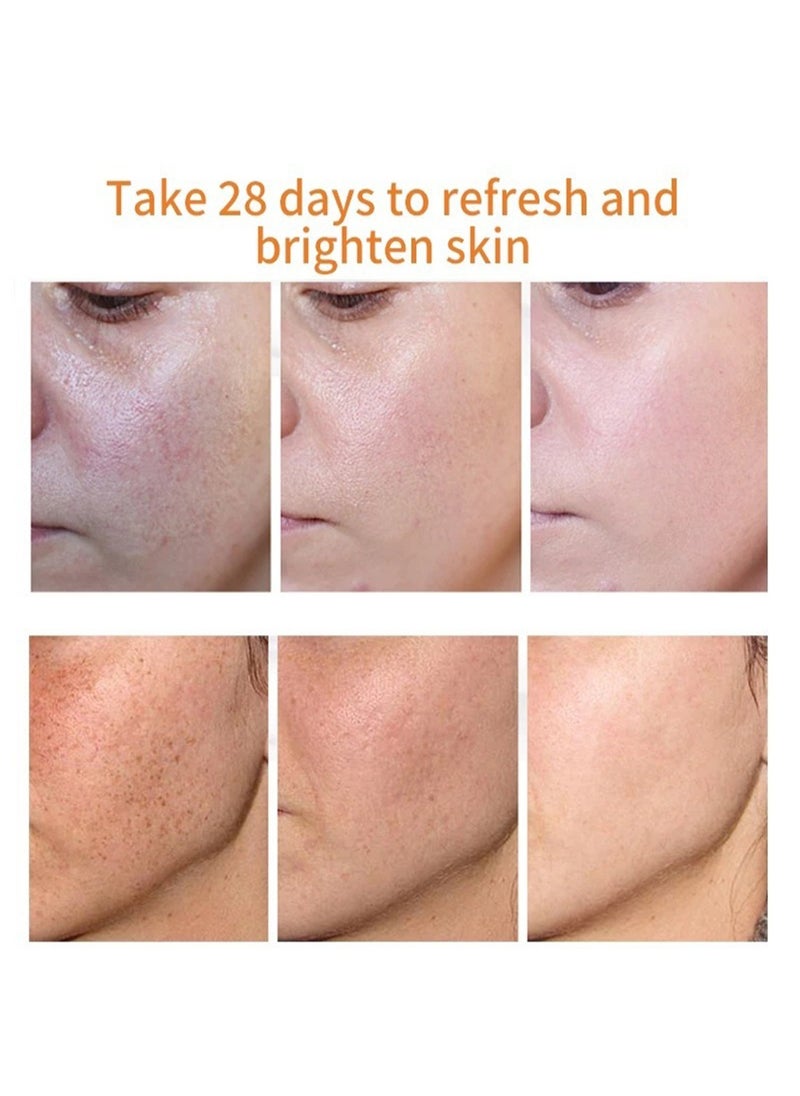 iBealee - Skin Whitening Freckle Cream, Anti-Spot Face Cream, White Lightening Beauty Blemish Face Treatment, Lightweight & Non-Greasy Face Moisturizer, for Day & Night Use, 20g - Image 1