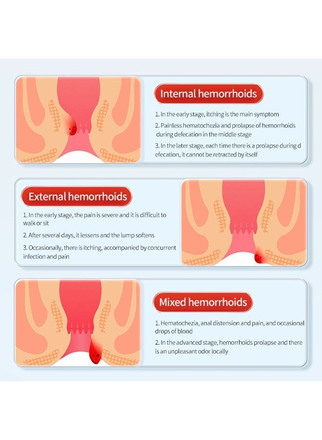 Botanical Formula Hemorrhoid Soothing Repair Cream Fast Itch & Pain Relief Long-Term Mucosal Repair For Internal External Mixed Hemorrhoids Private Home Care 30g - Image 2