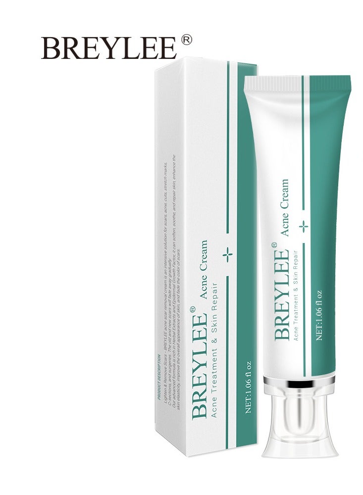 Breylee Acne Scar Cream Skin Repair Skin Care Scar Acne Treatment Whitening Cream - Image 1