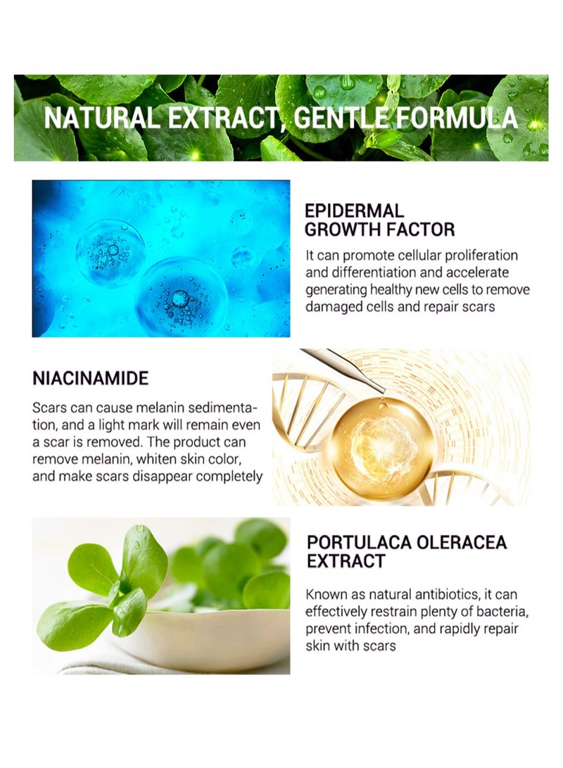 Breylee Acne Scar Cream Skin Repair Skin Care Scar Acne Treatment Whitening Cream - Image 2