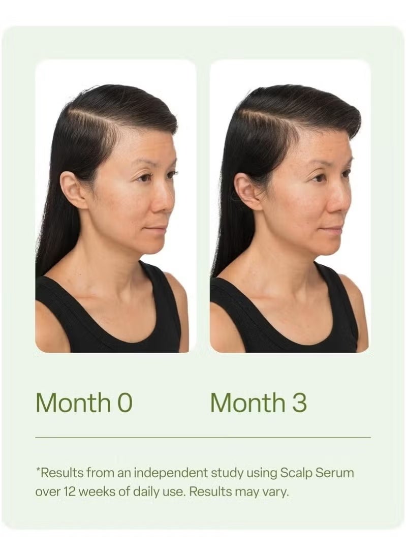 DiVi Scalp Serum for Thinning Hair, 30ml – Clinically Tested, Nourishing Formula with Amino Acids, Caffeine & Rosemary Oil – Promotes Healthy Scalp & Fuller-Looking Hair, Reduces Oil & Product Buildup - Image 5