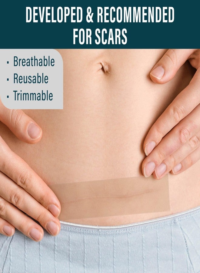Nuvadermis شريط سيليكون نوفاديرميس لندبات الجراحة - 120" × 1.5" لفة - شريط ندبات طبي لعلامات التجاعيد، ندبات الجراحة، ندبات الكيلويد، وندبات التضخم - لفة أوراق ندبات قابلة لإعادة الاستخدام - عبوة 2 - Image 3