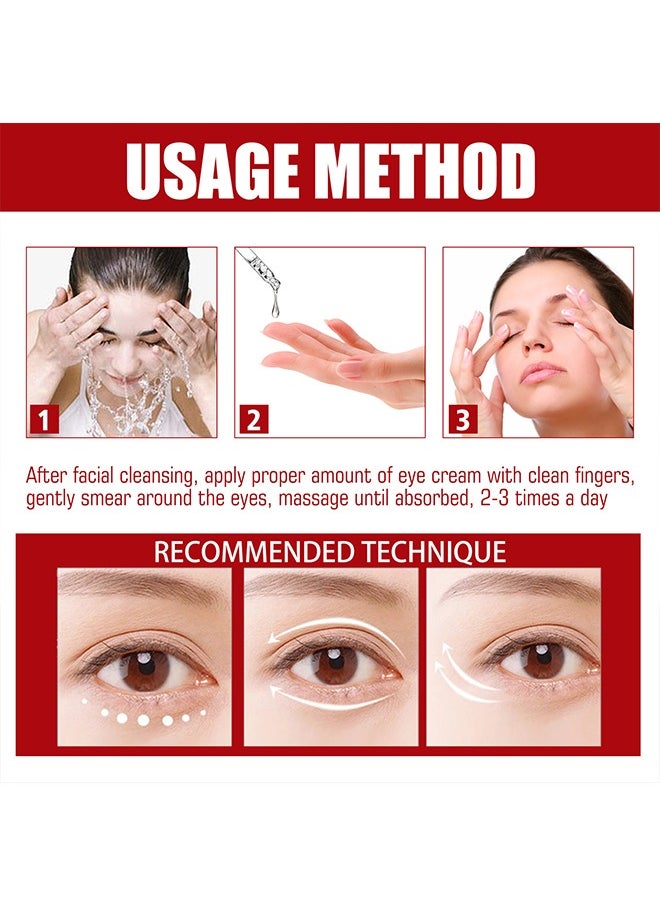 SOUTH MOON - Milia Remover Essential 30ml, Milia Spot Removal Helps to Ruduce Milia, for Dark Circles Under Eye for Women, Anti Aging, Anti Wrinkle, Reduces Bags, Saggy Skin and Puffy Eyes, Eye Care - Image 1
