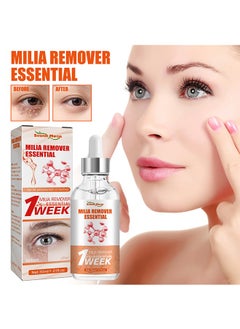 SOUTH MOON Milia Remover Essential 30ml, Milia Spot Removal Helps to Ruduce Milia, for Dark Circles Under Eye for Women, Anti Aging, Anti Wrinkle, Reduces Bags, Saggy Skin and Puffy Eyes, Eye Care  - Image 1