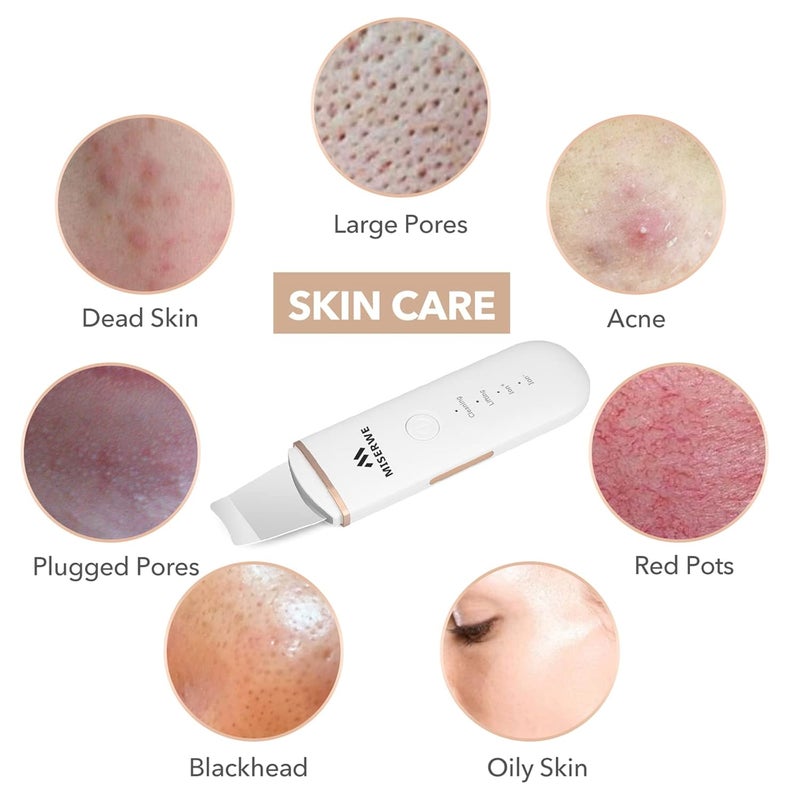 Miserwe Skin Scrubber Face Skin Spatula Facial Scrubber Spatula for Deep Cleansing Blackhead Remover Pore Cleaner with 4 Modes (White) - Image 3