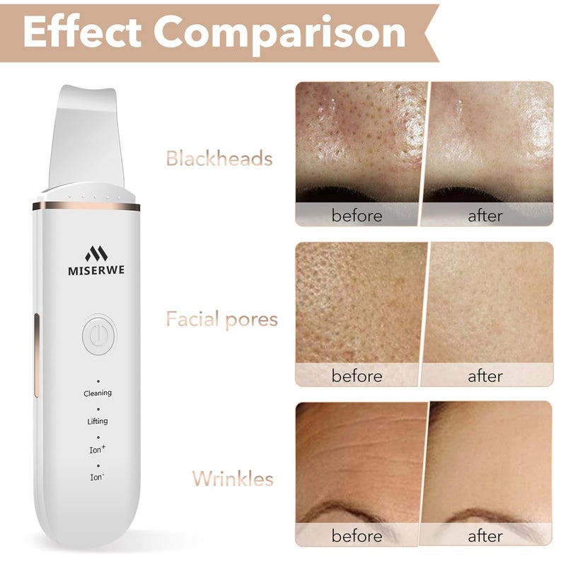 Miserwe Skin Scrubber Face Skin Spatula Facial Scrubber Spatula for Deep Cleansing Blackhead Remover Pore Cleaner with 4 Modes (White) - Image 4