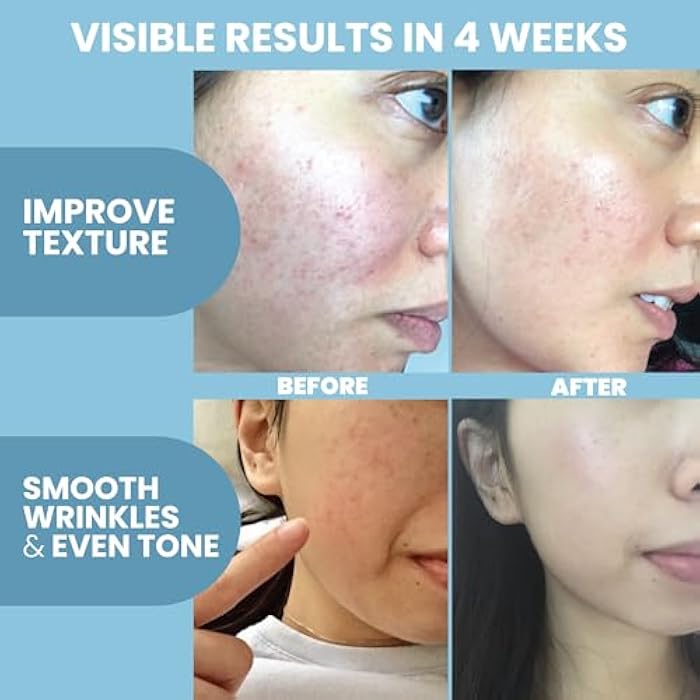 Eva Naturals Collagen Peptide Serum for Face – Anti Aging Facial Treatment with Peptides & Hyaluronic Acid – Gentle Formula for Sensitive Skin, Microneedling Pen, Derma Roller, Skin Firming & Hydrating (1 Oz) - Image 3