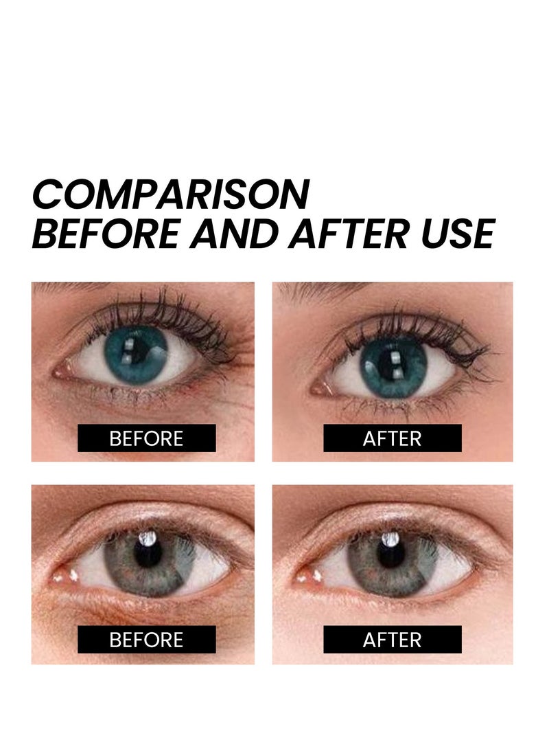 West&Month - Instant Firm Eye Tightener, Eye Firming Cream, Instant Under Eye Tightener, For Puffiness And Bags Under Eyes, Naturally Eliminate Wrinkles, Puffiness, Dark Circle and Bags 30ml - Image 1