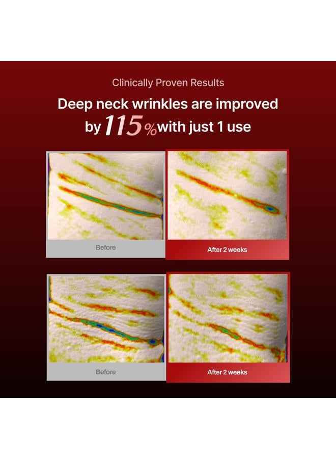 MEDITHERAPY Wrinkle fit Korean Mesh Sheet Masks for Neck (7EA), Collagen Mesh Sheet Mask for Neck Care, Hyaluronic acid Neck Mask, Korean Skincare - Image 4