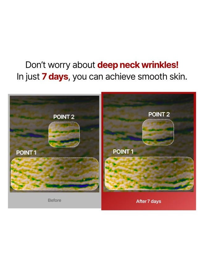 MEDITHERAPY Wrinkle fit Korean Mesh Sheet Masks for Neck (7EA), Collagen Mesh Sheet Mask for Neck Care, Hyaluronic acid Neck Mask, Korean Skincare - Image 5