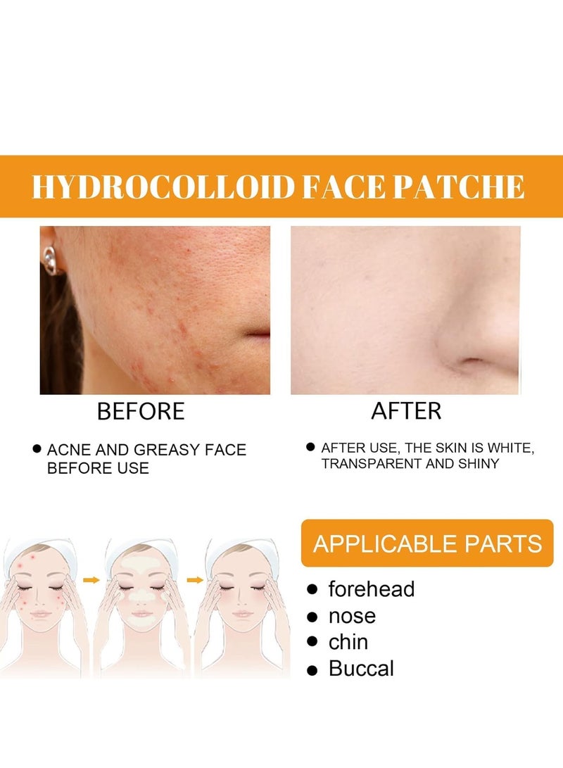 إيلهو رقعة بثرة حب الشباب ، رقعة بثرة حب الشباب للوجه الغروانية المائية 20 قطعة / صندوق (4 قطع * رقعة مقدمة + 4 قطع * رقعة أنف + 4 قطع * خد * رقعة الذقن + 8 قطعة * رقعة الخد) محمول - Image 5