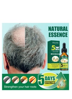 EELHOE Ginger Hair Liquid Chinese 30ml, Has The Effect Of Reactivating Hair Regeneration, Reducing Hair Loss, Strengthening And Firming Hair, And Achieving Dense Hair