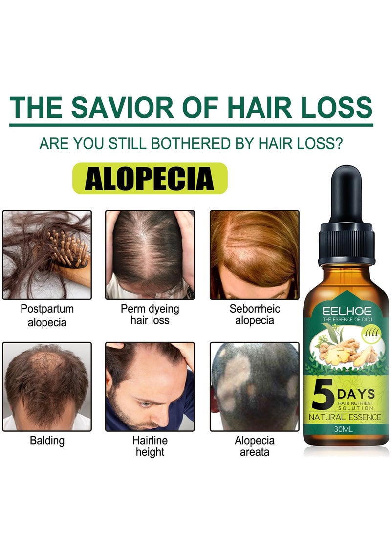 EELHOE - EELHOE Ginger Hair Liquid Chinese 30ml, Has The Effect Of Reactivating Hair Regeneration, Reducing Hair Loss, Strengthening And Firming Hair, And Achieving Dense Hair - Image 1