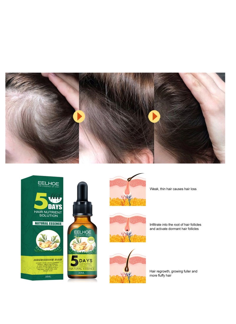 EELHOE - EELHOE Ginger Hair Liquid Chinese 30ml, Has The Effect Of Reactivating Hair Regeneration, Reducing Hair Loss, Strengthening And Firming Hair, And Achieving Dense Hair - Image 1