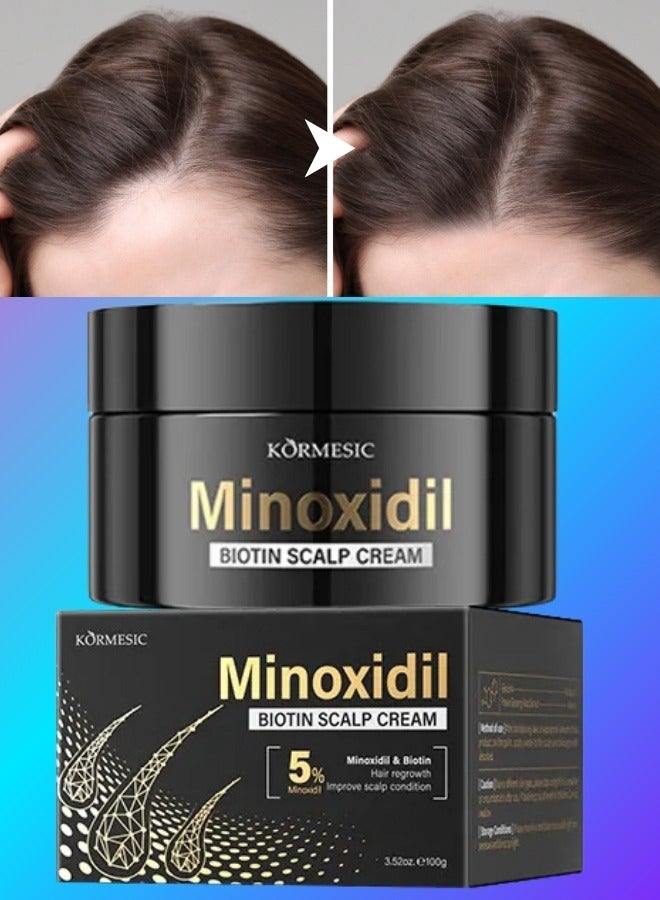 Kormesic كريم فروة الرأس بيوتين مينوكسيديل 5% 100 جرام لعلاج نمو الشعر مع مينوكسيديل 5% لتقوية الشعر وتعزيز نموه وتقليل تساقط الشعر واستعادة قوام الشعر وقوته وتحسين حالة فروة الرأس - Image 1