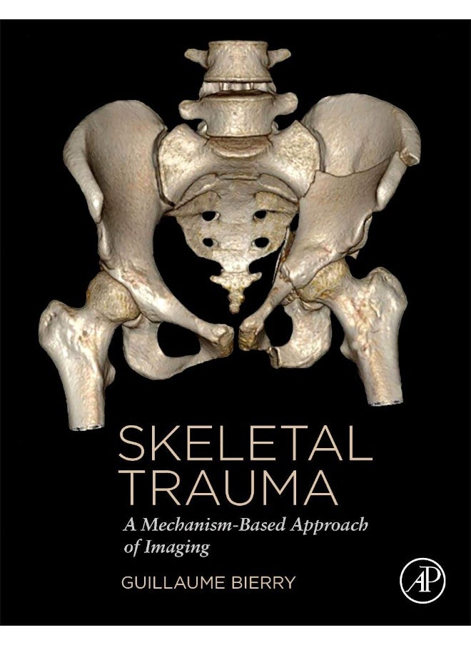 Skeletal Trauma: A Mechanism-Based Approach of Imaging