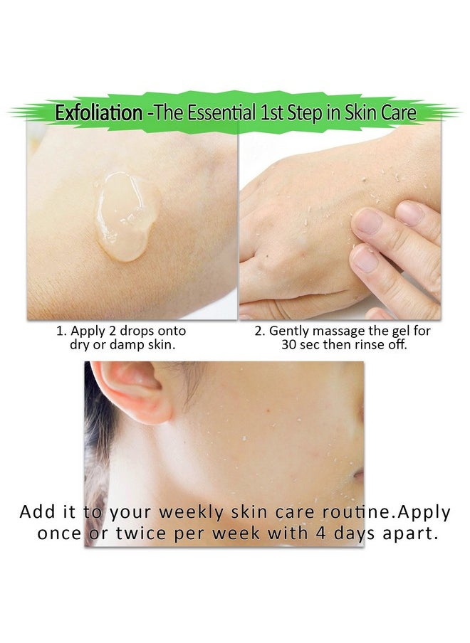 Care Me - Facial Exfoliating Gel, Non-Scrub Gentle Exfoliantor for Face & Body, Exfoliates, Peels, and Removes Dead Skin Cells, Reveals Glowing, Brighter Skin, 150 ml/5 fl oz - Image 1