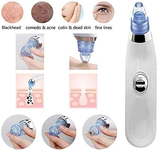 Nirvik Blackhead Remover Pore Vacuum - Electric Microdermabrasion Machine Black Head Cleaning Tool Pimple Sucker & Facial Cleanser Device for Pores Acne Nose Skin (Multi) - Image 5