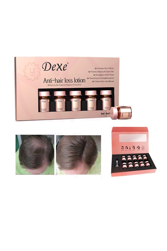 Dexe DEXE Anti-hair Loss HAIR LOTION 6ML*10pcs (10PCS/PACK)  - Image 3