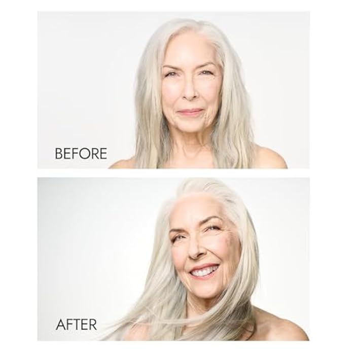 ion Dry Shampoo - Image 3