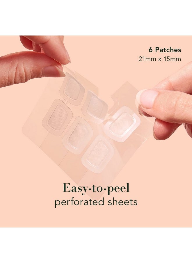 Rael - Ael Pimple Patches Miracle Microcrystal Spot Cover Dark Spot Corrector Hydrocolloid Post Acne With Skin Brightening For All Skin Types Vegan Cruelty Free (6 Count) - Image 1