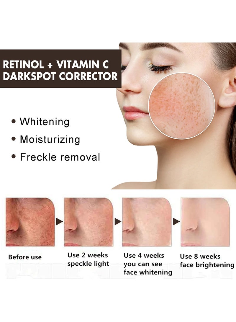 EELHOE Dark Spot Repair Cream Fade Dark Spots and Chloasma It is a moisturizing and nourishing cream that softens the skin - Image 4