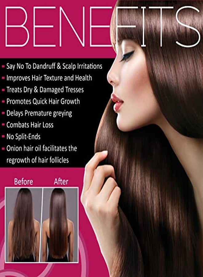 Pink Root Onion Oil 100ml, Pack of 1 - Image 4