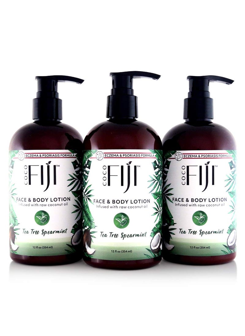 Organic Fiji - Coco Fiji Face  Body Lotion Infused With Coconut Oil  Lotion for Dry Skin  Moisturizer Face Cream  Massage Lotion for Women  Men  Tea Tree Spearmint 12 oz Pack of 3 - Image 1