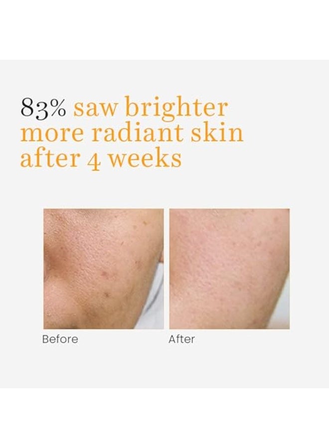 O3+ Vitamin C Serum Glow- Face & Neck Serum- Combination Skin-30ml - Image 3