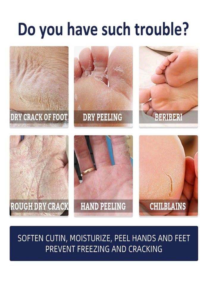 Jaysuing Ultra Moisturizing Cream ,Foot And Hand Cream With Shea Butter & Beeswax, Cracked Heel Repair Cream for Dry, Rough Feet, Callus & Heel Relief, Softening and Hydrating for Hands & Feet - Image 5