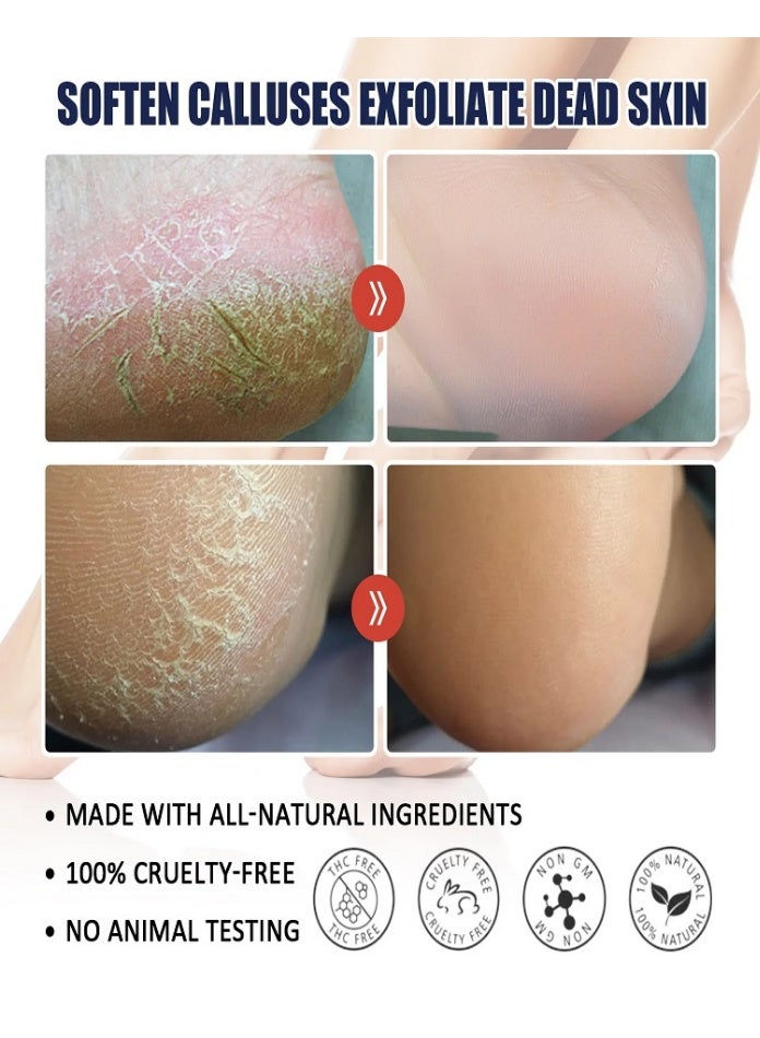 Jaysuing Ultra Moisturizing Cream ,Foot And Hand Cream With Shea Butter & Beeswax, Cracked Heel Repair Cream for Dry, Rough Feet, Callus & Heel Relief, Softening and Hydrating for Hands & Feet - Image 3