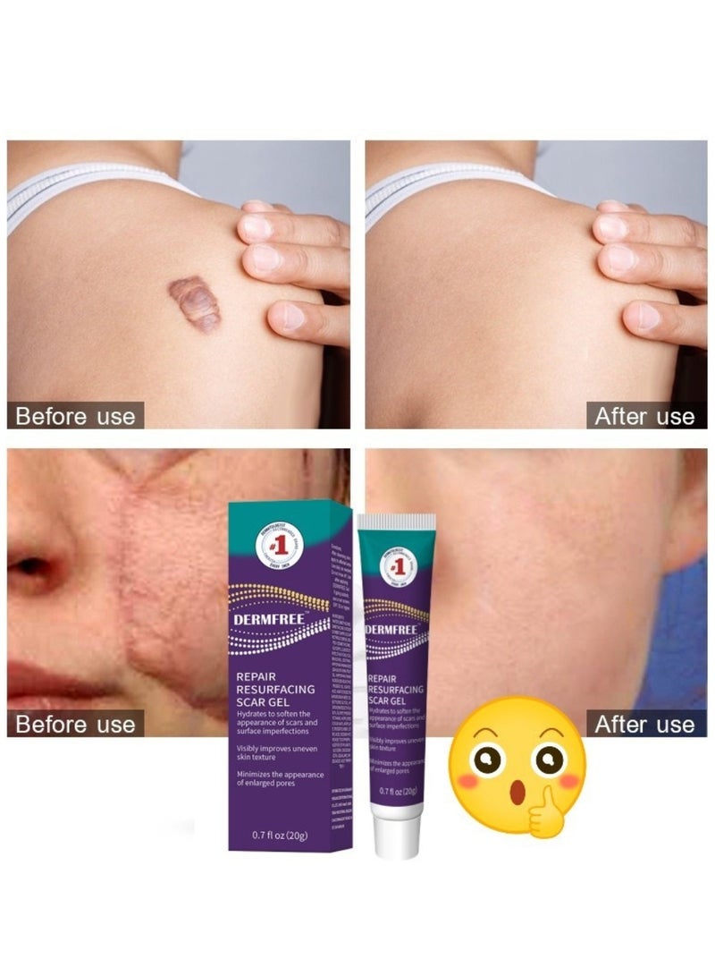 DERMFREE Repair Resurfacing Scar Gel Scar Removal Cream Reduce Scars and Marks for Dead Skin Elimination Minimize Pores Damaged Skin Acne Scars Pregnancy Lines Hydrates and Skin Repair 20g - Image 2