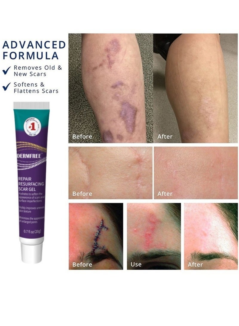 DERMFREE Repair Resurfacing Scar Gel Scar Removal Cream Reduce Scars and Marks for Dead Skin Elimination Minimize Pores Damaged Skin Acne Scars Pregnancy Lines Hydrates and Skin Repair 20g - Image 3