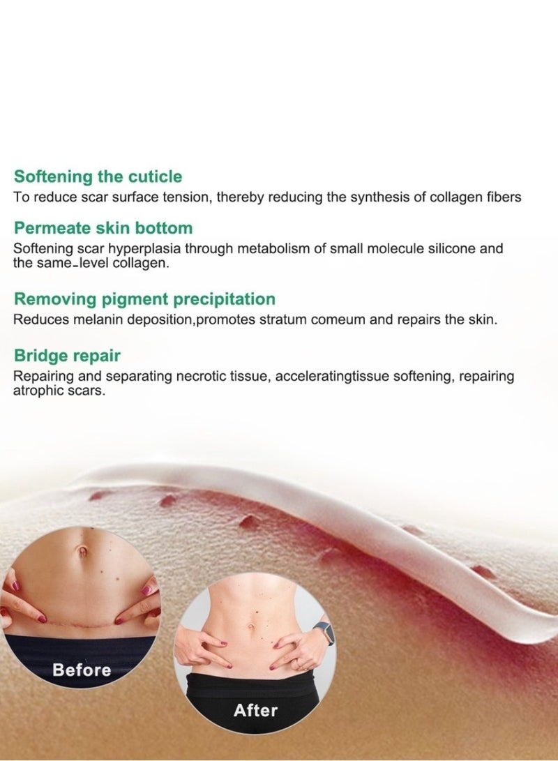 DERMFREE Repair Resurfacing Scar Gel Scar Removal Cream Reduce Scars and Marks for Dead Skin Elimination Minimize Pores Damaged Skin Acne Scars Pregnancy Lines Hydrates and Skin Repair 20g - Image 4