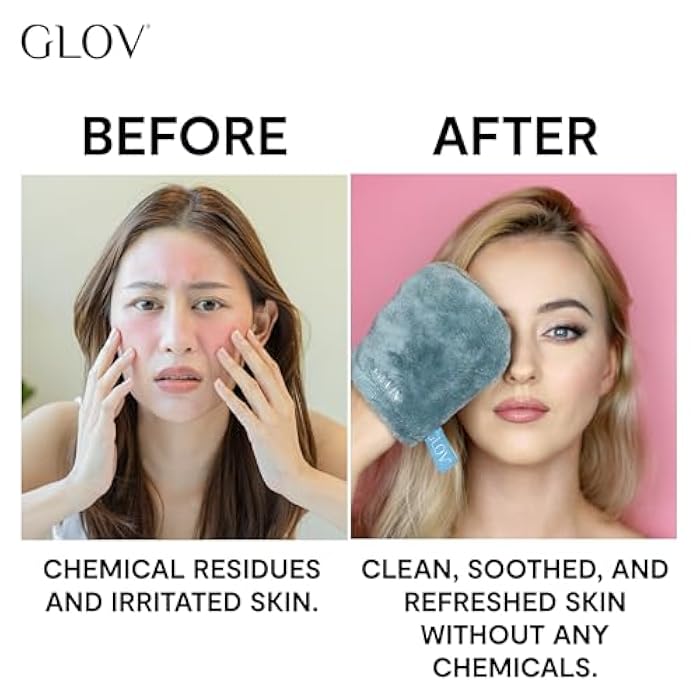 GLOV Expert Dry Skin - Image 3