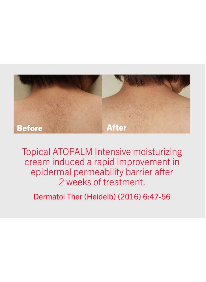 Atopalm - ATOPALM Intensive Moisturizing Cream for Dry & Sensitive Skin, Face Moisturizer, Replenishes Hydration, Paraben-Free, K-Beauty, skin barrier ceramide cream, 3.4 Fl Oz, 100ml (3.4 Fl Oz) - Image 1