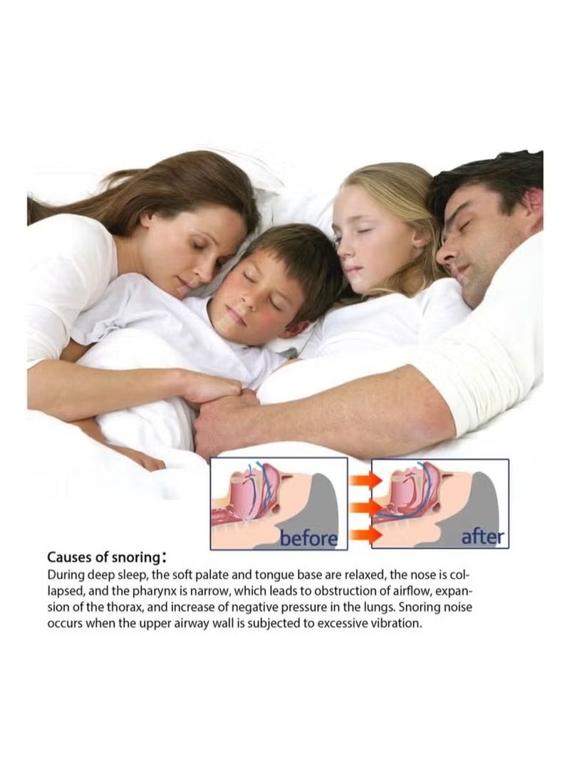 SOUTH MOON Snoring Adhesive Tape 9 Meters For Adults And Children - Image 2